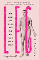 Cover of Leg: The Story of a Limb and the Boy Who Grew from It